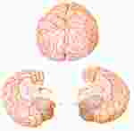 Brain Model with Two-Parts for Anatomy Studies