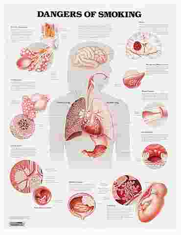 Dangers of Smoking Chart
