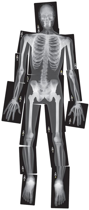 Human X-Ray Set for Anatomy Studies