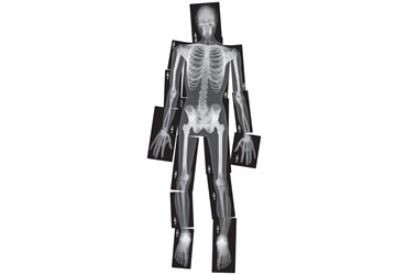 Human X-Ray Set for Anatomy Studies