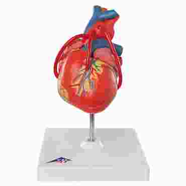 Classic Heart with Bypass, 2-Part Model