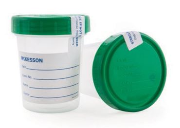 Sterile Specimen Container