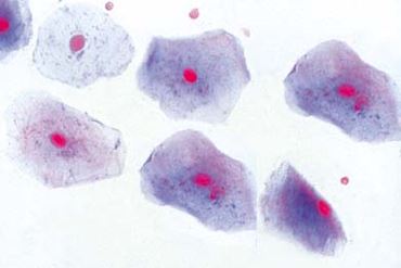 Mouth Smear Microscope Slide