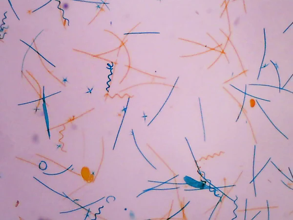 Stagnant Water Microscope Slide