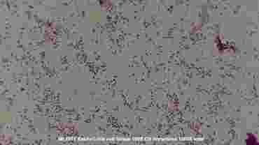 Escherichia coli Smear Microscope