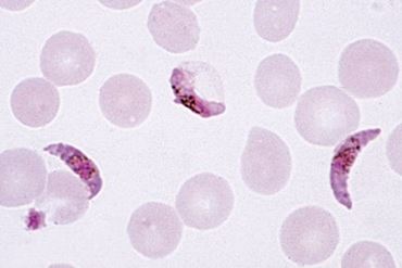 Plasmodium Smear Microscope Slide