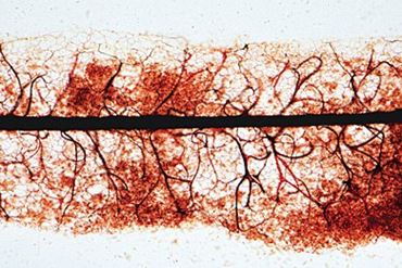 Stemonitis Microscope Slide