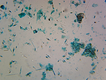 Marine Diatoms Microscope Slide