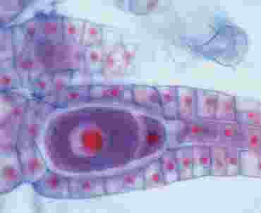 Marchantia Microscope Slide, Archegonial Section