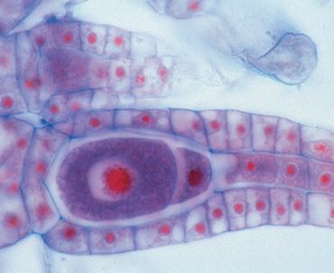 Marchantia Microscope Slide, Archegonial Section