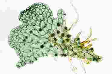 Fern prothallium Microscope Slide with Antheridia and Archegonia