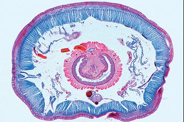 Lumbricus terrestris Microscope Slide