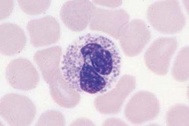 Normal Human Blood Microscope Slide, Wright Stain