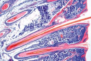 Human Scalp Microscope Slide