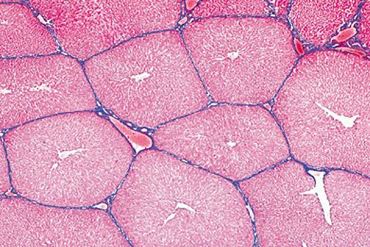 Liver Microscope Slide