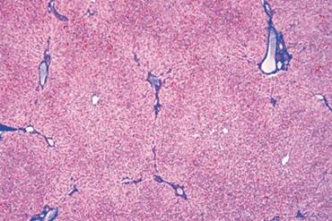 Human Liver Microscope Slide