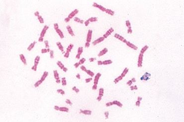 Male Human Chromosome Microscope Slide