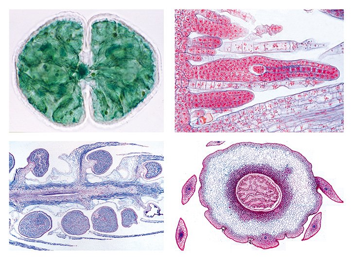 Cryptogamae Microscope Slide Sets