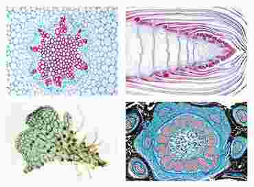 Ferns and Fern Allies Slide Set