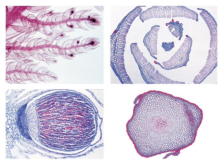 Liverworts and Mosses Slide Set