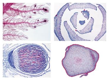 Liverworts and Mosses Slide Set