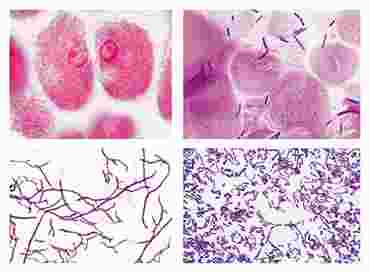 Bacteria Slide Sets