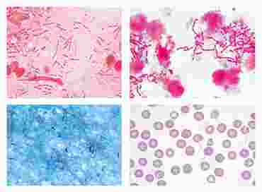 Bacteria Slide Sets