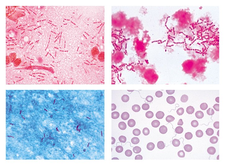 Pathogenic Bacteria Slide Set