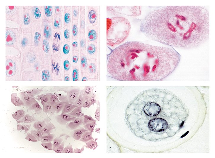 Mitosis and Meiosis Slide Sets