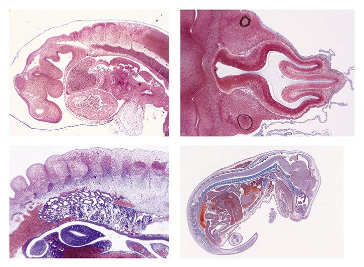 Embryology Slide Sets