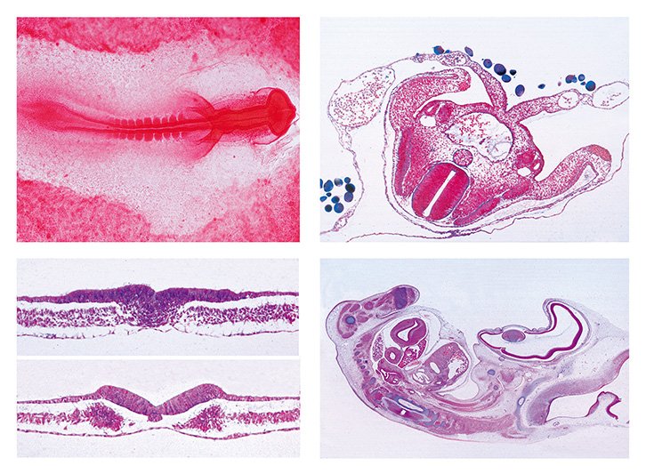Embryology Slide Sets