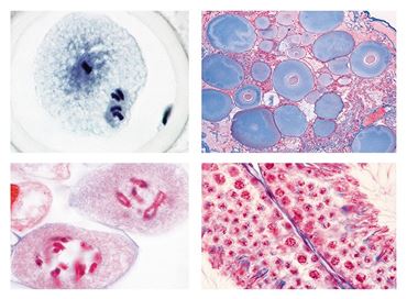 Genetics Slide Set for Biology and Life Science