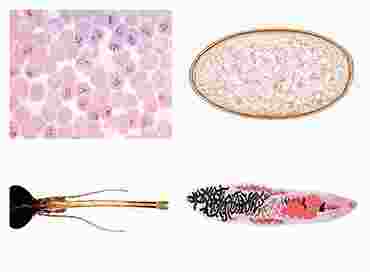 Parasite, Pathogenic Bacteria and Insect Pests for Veterinary Medicine Slide Set for Biology and Life Science